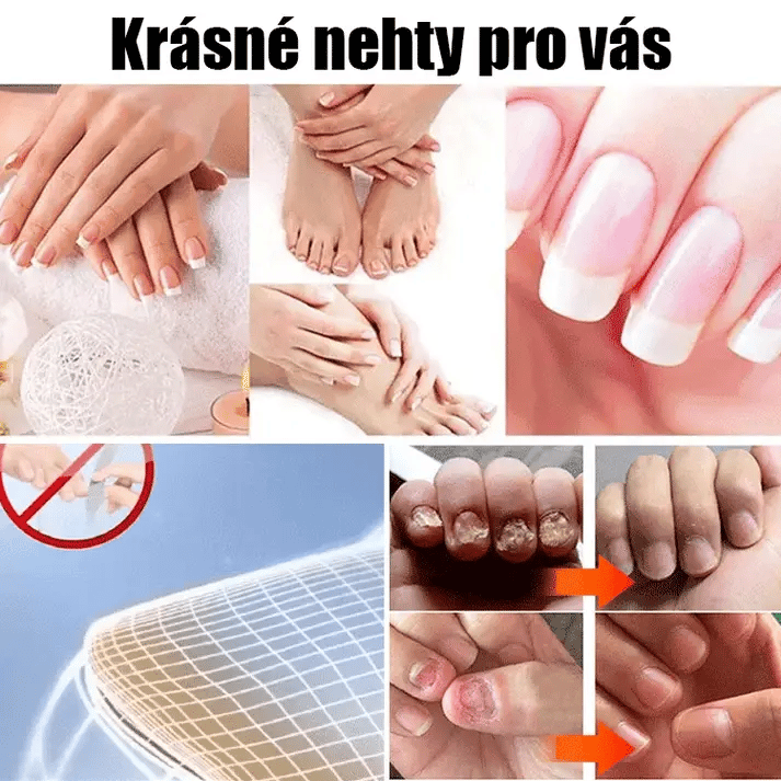 Nail treatment cream