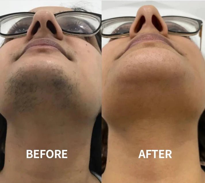 🔥Gentle and Painless Facial Hair Removal Cream - Denna