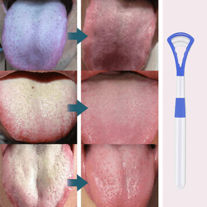 BreathRefresh Tongue Scraping Cleaner(2Pcs)
