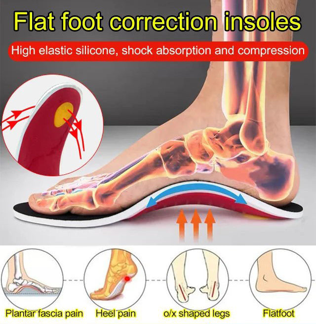 Leg correction arch support insole