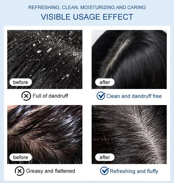 Selenium dioxide shampoo — — Anti-dandruff, anti-itching, oil control - Denna