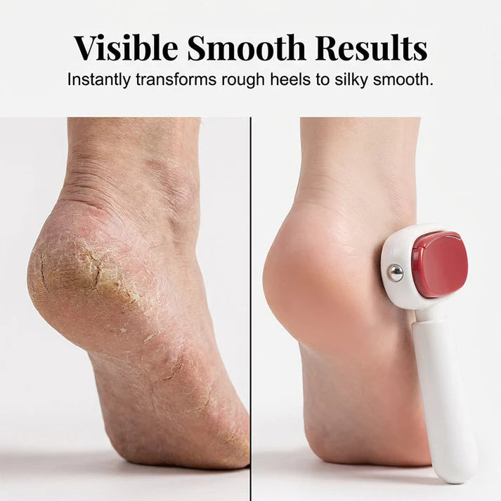 🔥Double-Sided Foot Scraper for Callus Removal