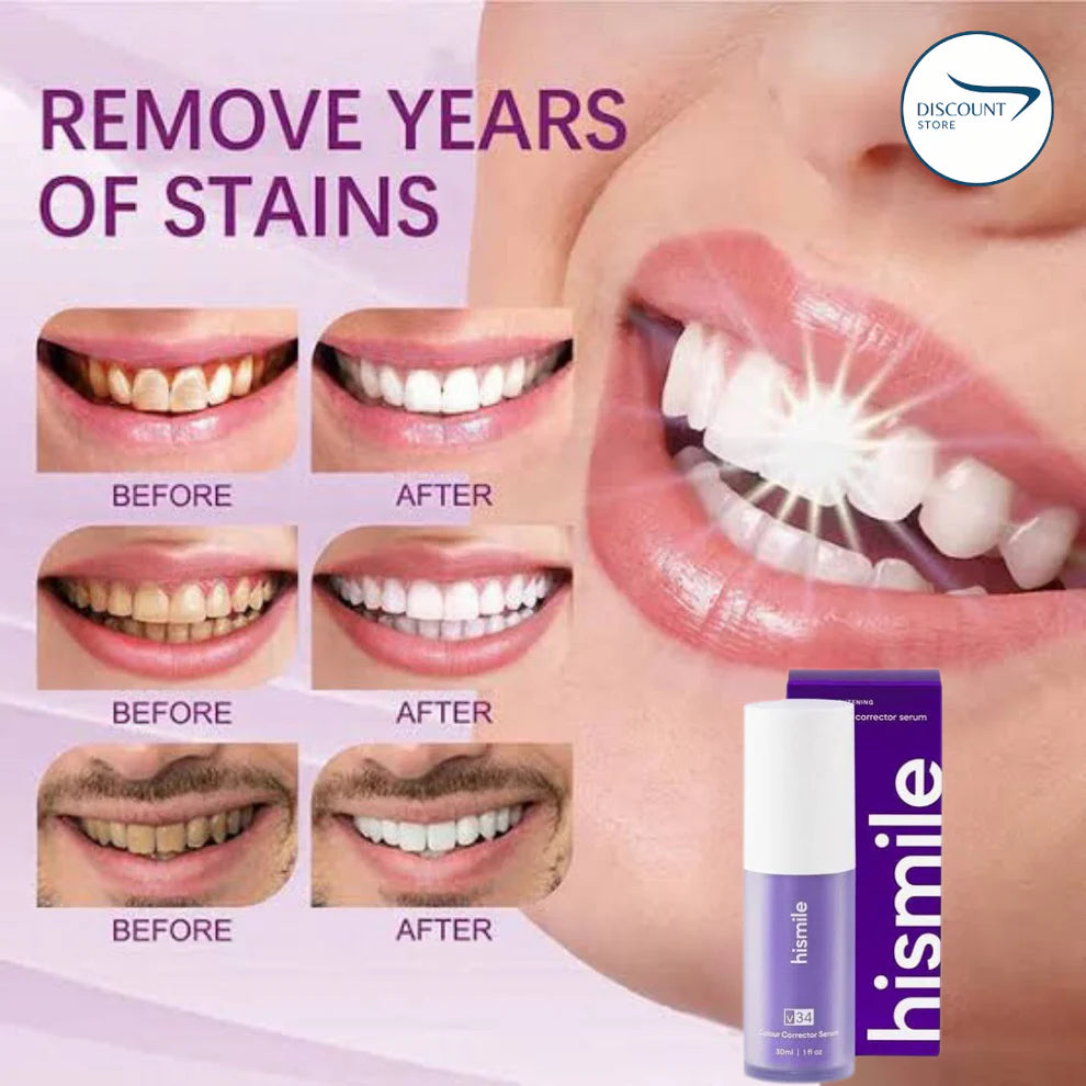 V34 Teeth Whitening Serum - (IMPORTED)