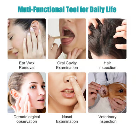 🔥Clean Earwax-Wi-Fi Visible Wax Removal Spoon, USB 1296P HD Load Otoscope