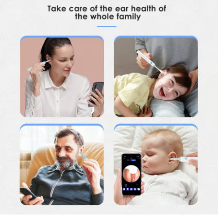 🔥Clean Earwax-Wi-Fi Visible Wax Removal Spoon, USB 1296P HD Load Otoscope