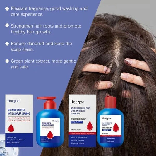 Selenium dioxide shampoo — — Anti-dandruff, anti-itching, oil control - Denna